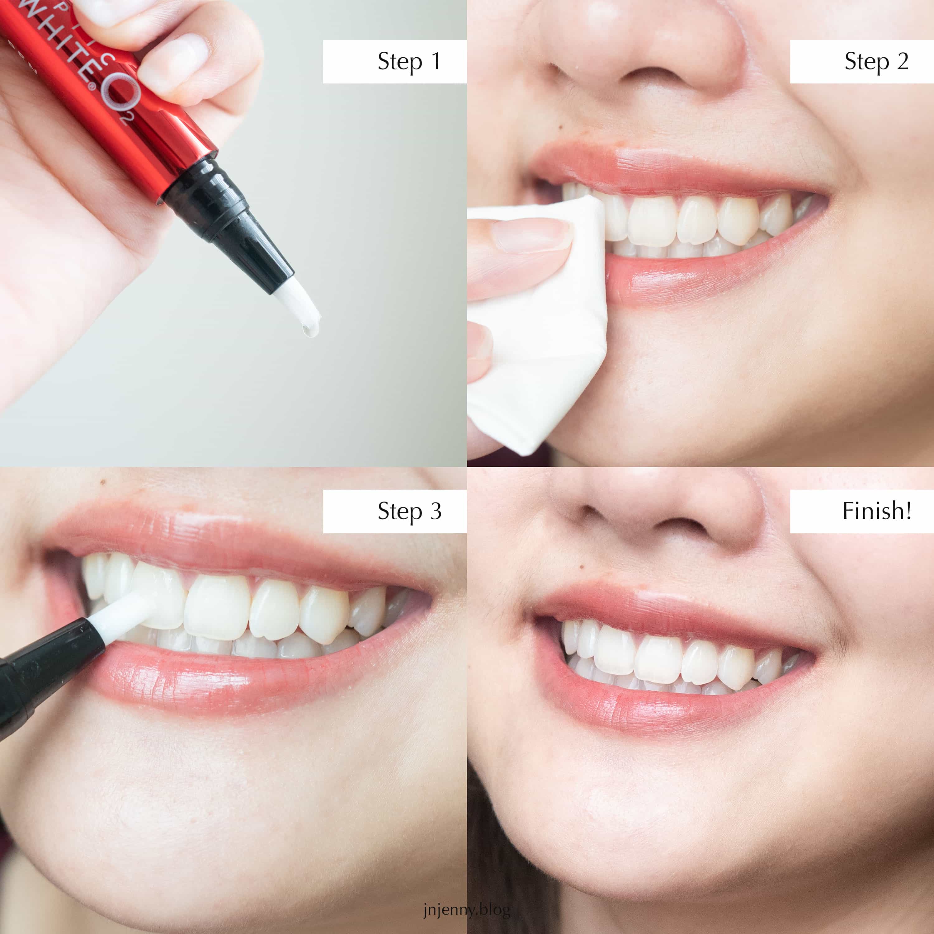 Review ] รีวิวปากกาฟอกฟันขาว Colgate Optic White O2 Teeth Whitening Pen  ฟันขาวง่ายๆ ไม่เสียวฟัน